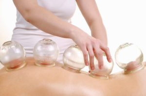 Cupping Treatment