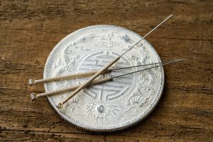 Decorative photo of acupuncture needles